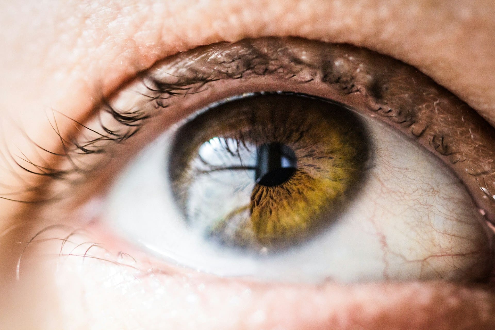 Leia mais sobre o artigo O que provoca pterígio no olho? Conheça as causas, sintomas e formas de prevenção dessa condição ocular silenciosa